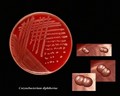 corynebacterium diphtheriae